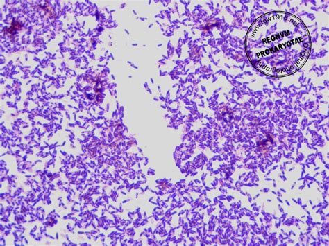 Bacillus Coagulans Gram Stain