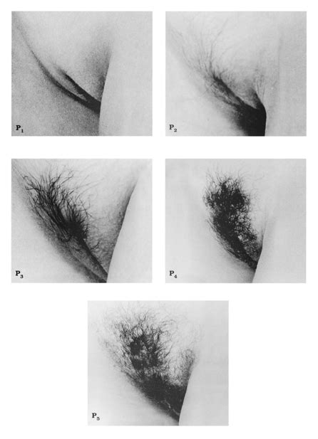 Hair Growth Stages Hot Sex Picture