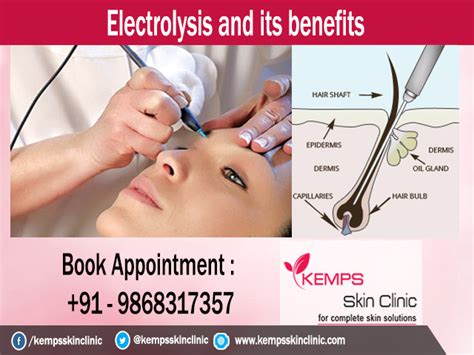 Electrolysis And Its Benefits Kemps Skin Clinic