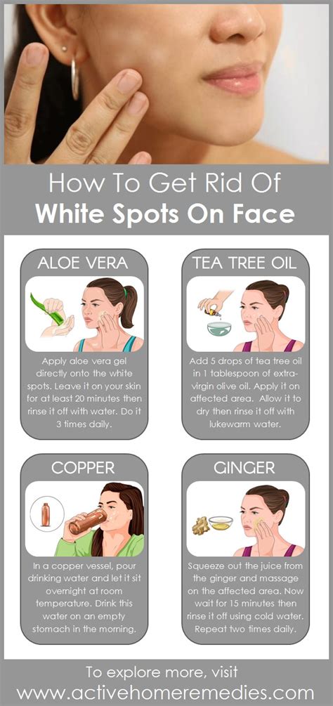 How To Get Rid Of White Spots On Face Active Home Remedies