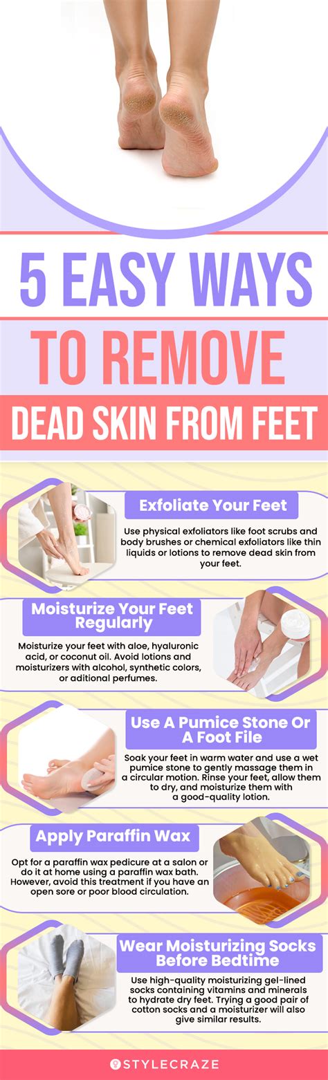 Dead Skin Under Feet Causes Symptoms And Treatment