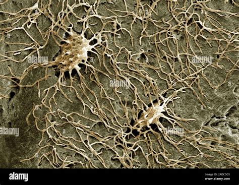Las Células óseas Osteocitos Color Micrografía Análisis De Electrones