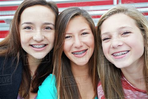 Teenage Girls Showing Off Braces Together Stock Photo Dissolve