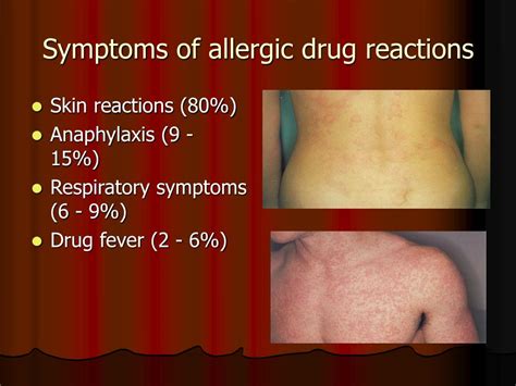 Ppt Drug Allergy Powerpoint Presentation Free Download Id