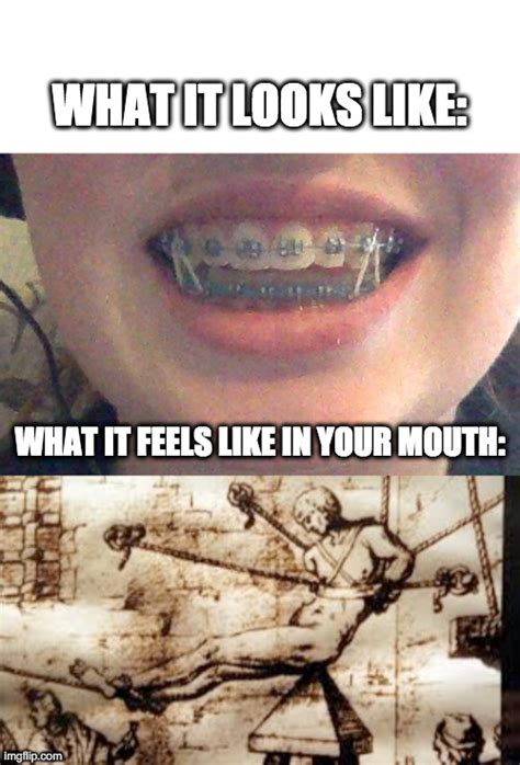 Braces Memes And S Imgflip
