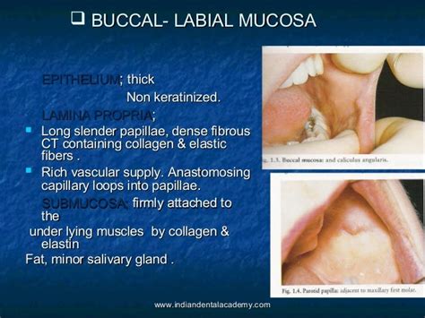 Oral Mucous Membrane Dental Crown And Bridge Courses