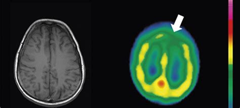 Brain Imaging With Spect And Pet Warwick Continuing Medical Education