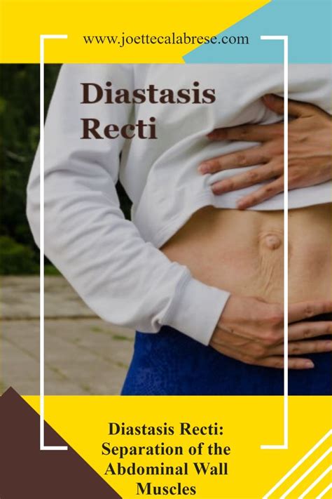 Diastasis Recti Separation Of The Abdominal Wall Muscles