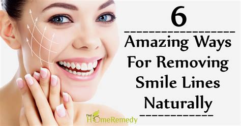 6 Amazing Ways For Removing Smile Lines Naturally Find Home Remedy