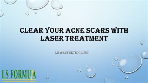 Ppt Clear Your Acne Scars With Laser Treatment Powerpoint