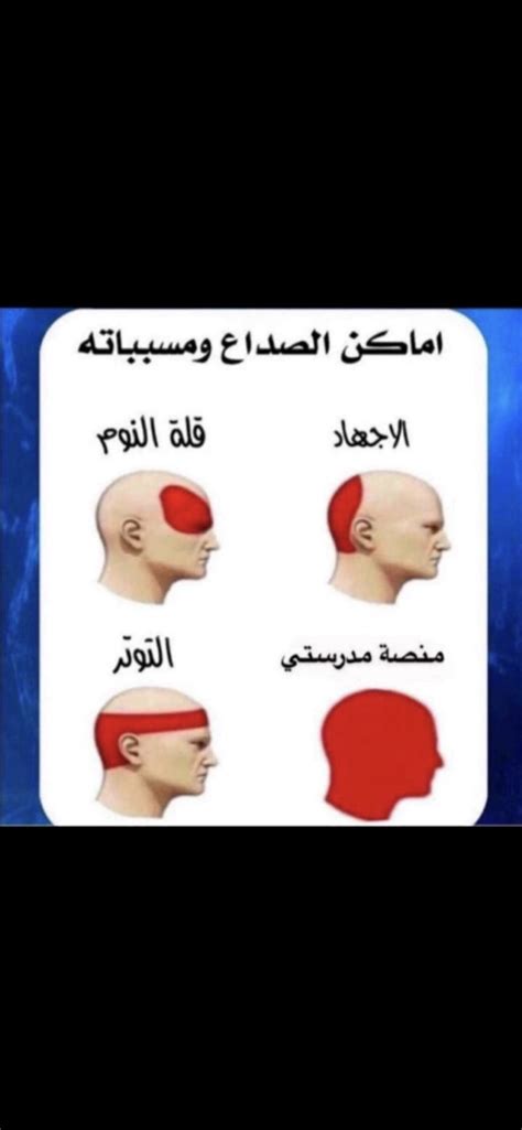 اماكن الصداع واسبابها