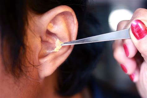 Ear Wax Removal In Tucson Tucson Audiologist Sonora Hearing Care Llc