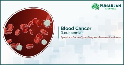 Blood Cancer Leukaemia Symptomscausestypesdiagnosistreatment