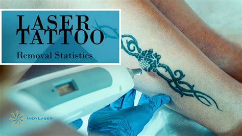Laser Tattoo Removal Statistics From Skin Care Experts Indy Laser