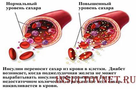 Диета геморрагического васкулит Питание после геморрагического инсульта: диета и составление меню Питание после геморрагического инсульта: диета и составление меню Диета геморрагического васкулит