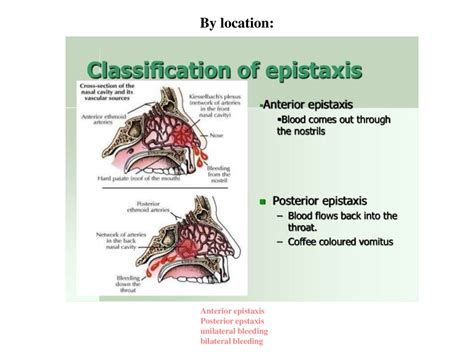 Epistaxis Online Presentation