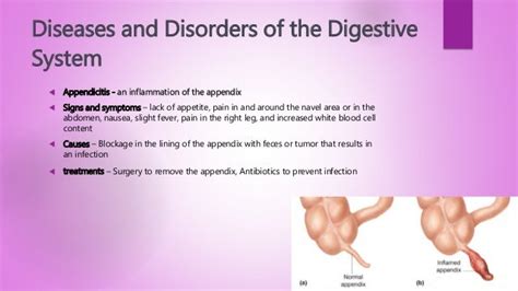 overview of the digestive system and diseases of it