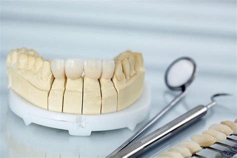 Maybe you would like to learn more about one of these? How long do porcelain veneers last?