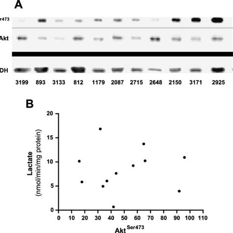 Effect Of Px 478 On Hif 1α And Glycolysis Dose Dependent Decrease In