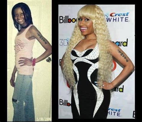 Nicki Minaj Before And After 8 Photos Nicki Minaj Celebrity