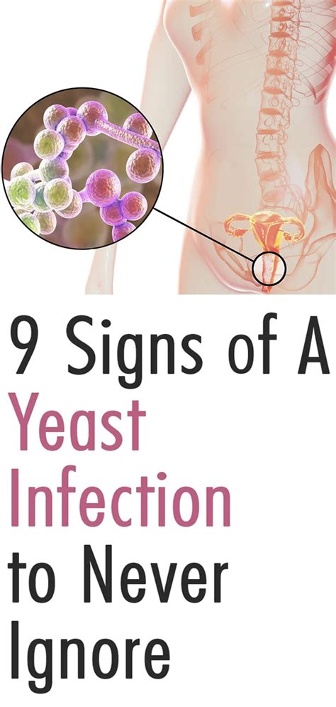 Can A Bartholin Cyst Cause A Yeast Infection A Potentially Dangerous