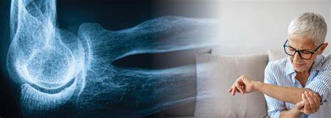 Остеопороз диета меню Остеопороз – широко распространенное заболевание. Остеопороз – широко распространенное заболевание. Остеопороз диета меню