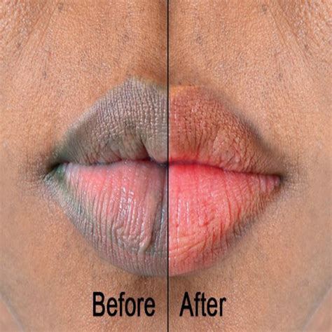 extreme lip lightening cream and strawberry lip scrub bundle sale lip lightening natural pink