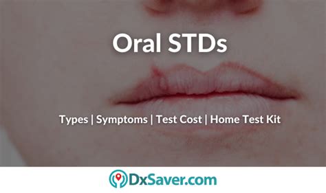 Signs Symptoms Of Oral Stds Treatment Testing Cost Near You