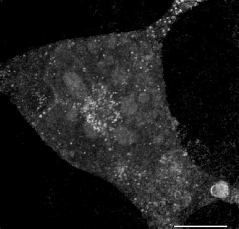 Unlocking Nature’s Disappearing Act: Human Cells Decipher the Secrets