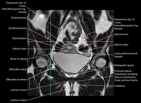 Free download and read female abdomen anatomy free ebooks. mri hip anatomy - www.unidadortopedia.com PBX: 6923370 ...