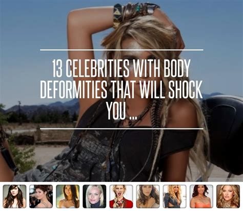 13 Celebrities With Body Deformities That Will Shock You Physical Lily Allen Kate