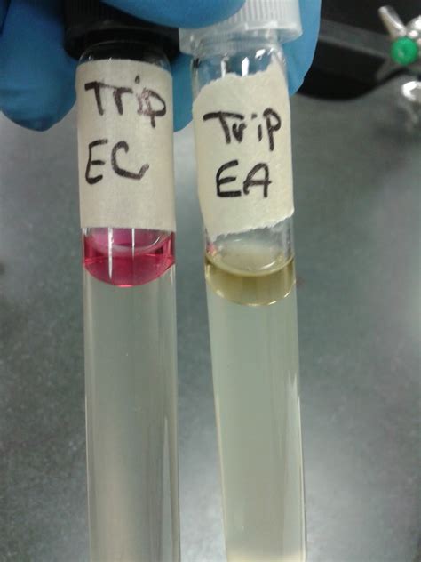 Microbiology Ejournal Day 14 Completed The Mrvpcitratetyrpt Tests
