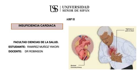 Insuficiencia cardiaca presentación Signos y síntomas Antecedentes