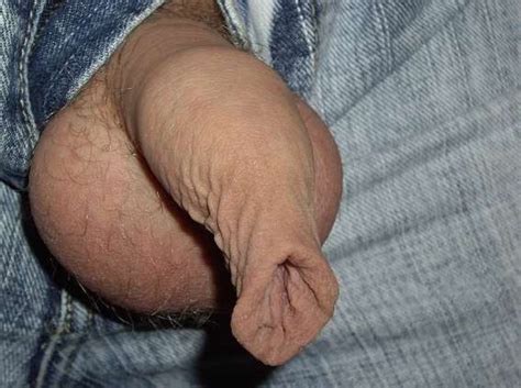 Foreskinfetish16 In Gallery Long Labia And Saggy