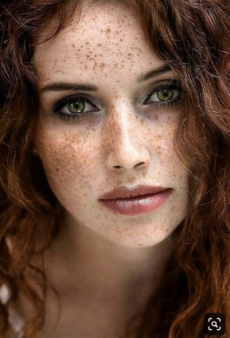 Beautiful Freckles Face