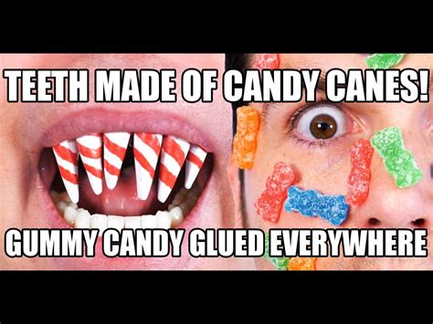 My Teeth Are Made Of Candy 😱 Mikes Candy Teeth Help Get Him Into