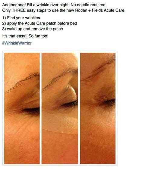 How To Reduce Wrinkle Without Injection