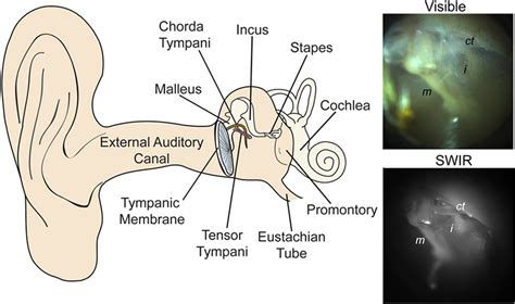 The osseous labyrinth includes the vestibular system (made up of the semicircular canals and the vestibule) and the cochlea. MIT Unveils Short-Wave Infrared Otoscope for New View of ...