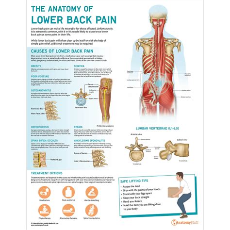 The Anatomy Of Lower Back Pain Chart Poster Laminated Ph