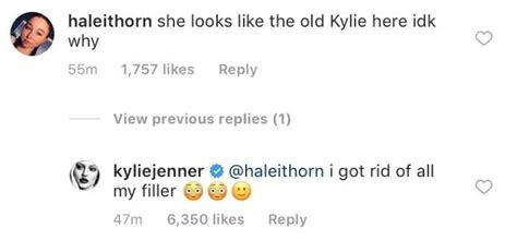 kylie jenner posts pic after getting all her lip filler removed nz herald
