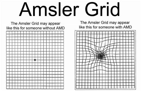 Amsler Grid Eyesight