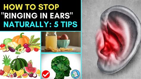 How To Stop Ringing In Ears Naturally Youtube