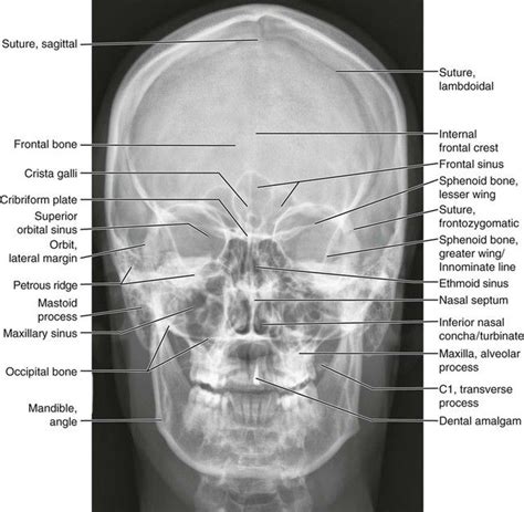 Skull Caldwell Radiology Technician Radiology Student Medical