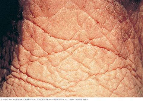 Wrinkled Skin Texture