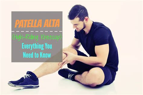 Patella Alta High Riding Kneecap Everything You Need To Know The