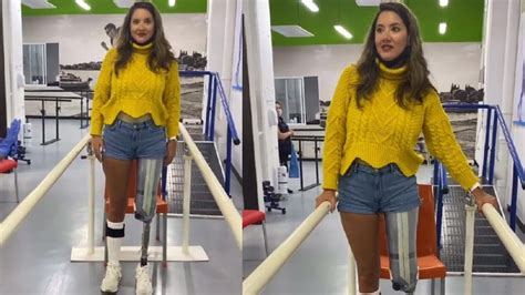 Daniella Álvarez da primeros pasos con su nueva prótesis de pierna YouTube