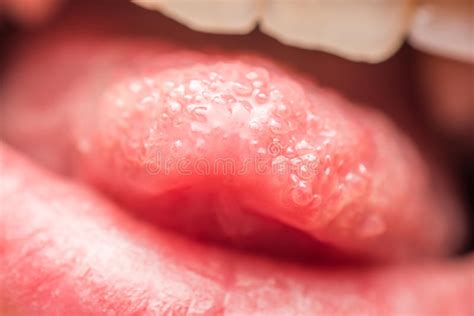 Healthy Human Tongue Taste Buds Macro Stock Photo Image