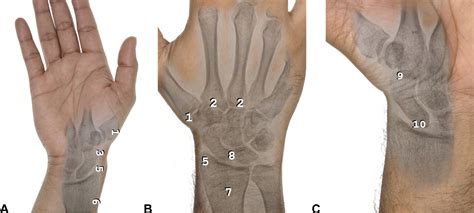 References in Examination of the Wrist: Radial-Sided Wrist ...