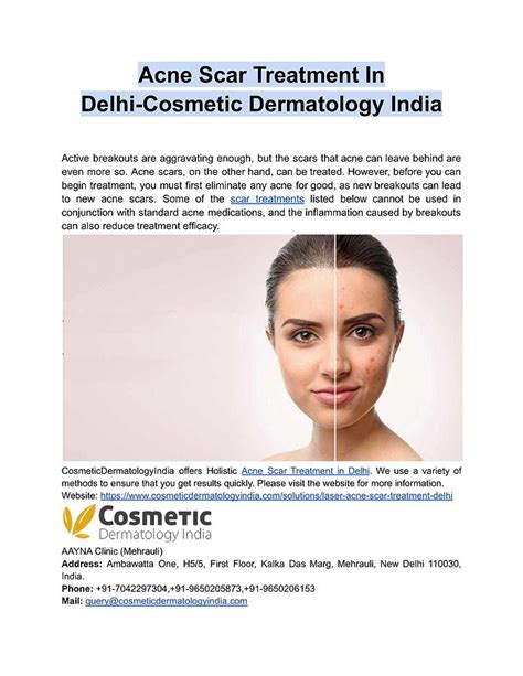 Acne Scar Treatment In Delhi Cosmetic Dermatology India Digital Art By