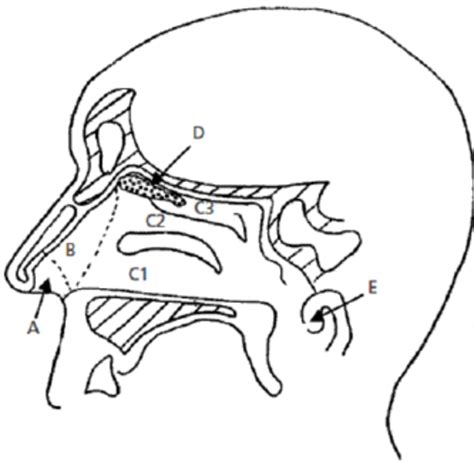 Sagittal Section Of The Nasal Cavity Showing The Nasal Vestibule A